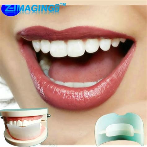 Adult Alignment teeth retainer orthodontic retainer buck teeth ...