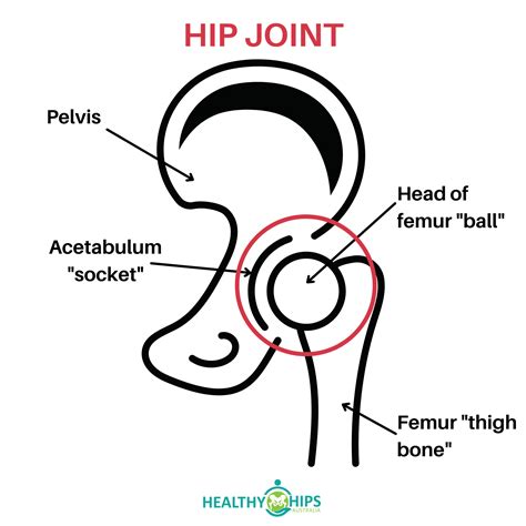 PAO surgery for hip dysplasia - Healthy Hips Australia