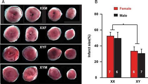 The Number Of X Chromosomes Influences Protection From Cardiac