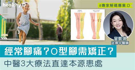 足部問題治療 膝痛、腳踝痛、跟膜炎、o型腳、x型腳成因為何？中醫正骨、針灸及刺血拔罐療法作治療直達患處 註冊中醫師吳凱琪