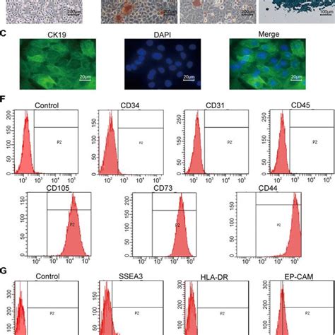 Characterization Of Hamscs Human Amniotic Mesenchymal Stem Cells And