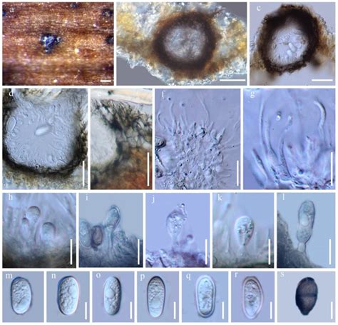 Lasiodiplodia Theobromae Facesoffungi Number FoF 00167 Faces Of Fungi