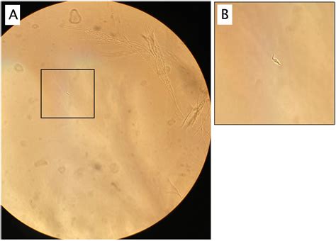 Trypanosoma Cruzi Ciclo De Vida 8