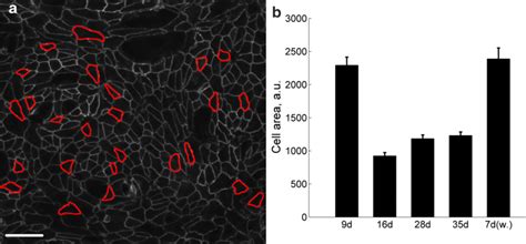 Cell Size Differences In To Day Cultured Hesc Rpe Cell Area Was