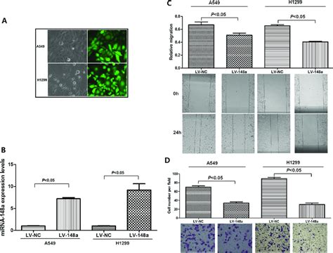 MiRNA 148a Suppresses Cells Migration And Invasion Of Lung Cancer A549