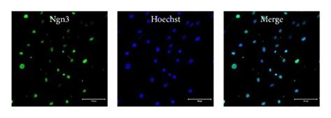 Key Pancreatic Transcription Factors Expressed In Hpmscs Pdx1 Ngn3