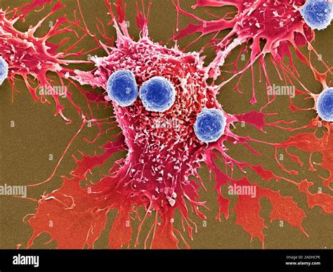 T Lymphocytes And Cancer Cells Coloured Scanning Electron Micrograph