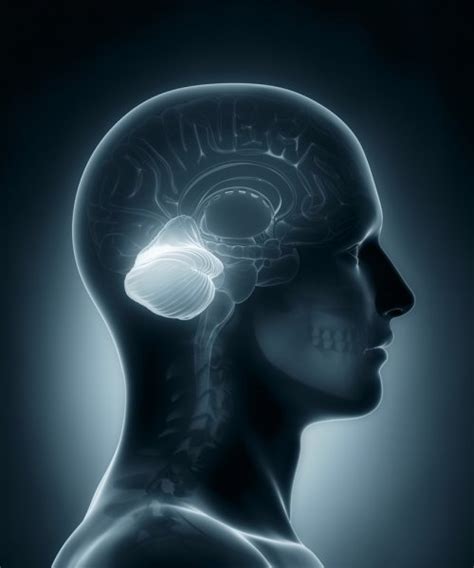 Female Brain Medical X Ray Scan Stock Photo Cliparea