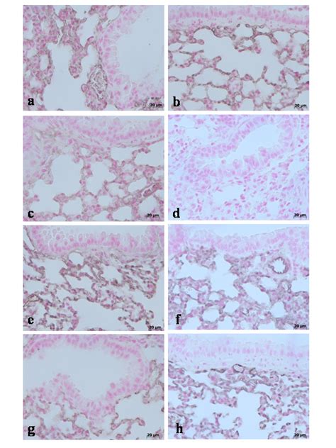 Immunohistochemical Localization Of Claudin 5 In The Lung In Lung