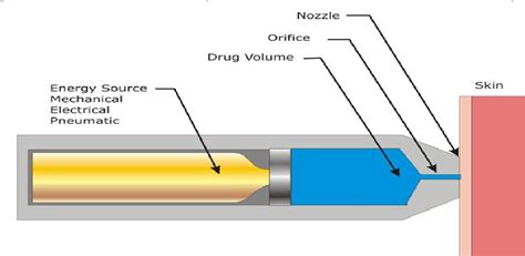 Figure From A Reiew On Needle Free Injection System Semantic Scholar