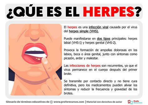 Qué es el Herpes Definición de Herpes