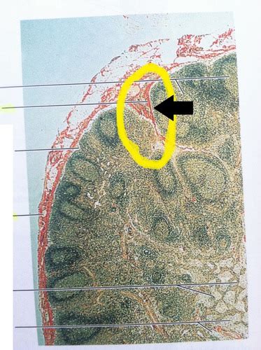 Lymph Node Histology Flashcards Quizlet