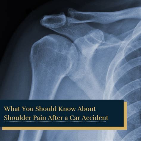 What You Should Know About Shoulder Pain After Car Accident