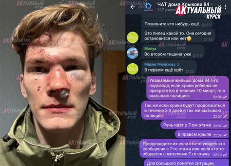 Продолжение истории с дракой на проспекте Клыкова. Делом занялась ...