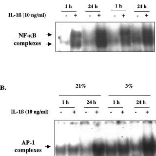 Effect of IL 1 β treatment on NF κ B and AP 1 DNA binding activity in