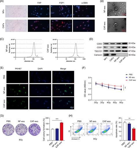 Exosomal MiR196a5p Enhances Radioresistance In Lung Cancer Cells By