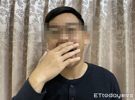 他扁桃腺「反覆化膿」！ 醫一驗確診愛滋病 Ettoday健康雲 Ettoday新聞雲