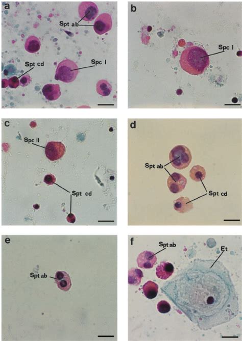 In Ammatory Cells In Blood And Semen Smears A C Blood Smears