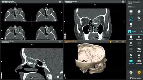 DICOM ViewerMedical Image Manipulation YouTube