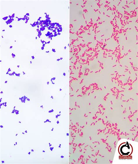 Tinción de Gram en Microbiología La Herramienta Esencial para la