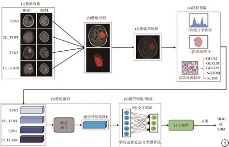 基于多参数mri影像组学特征融合模型鉴别高级别胶质瘤与单发性脑转移瘤 磁共振成像