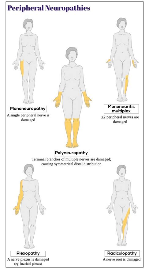 Peripheral Neuropathies Medicine Keys For Mrcps