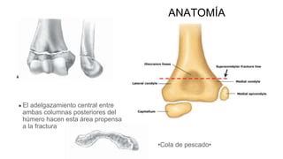 FRACTURA SUPRACONDÍLEA HÚMERO 3 Copia pptx