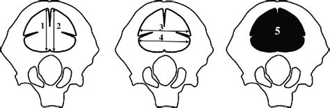 Measurement Scheme Of The Primary Ossification Center Of The Occipital Download Scientific