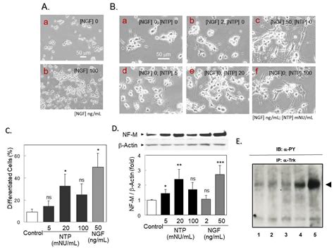 Ijms Free Full Text Neuroprotection By Neurotropin Through