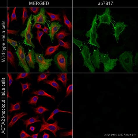 Anti Alpha Smooth Muscle Actin Antibody 1a4 Ko Tested Ab7817 Abcam