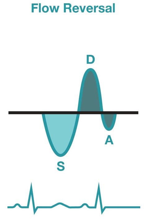 Pulmonary Venous Flow