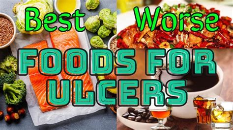 Ulcer Diet Plan Foods To Include And Foods To Exclude Youtube