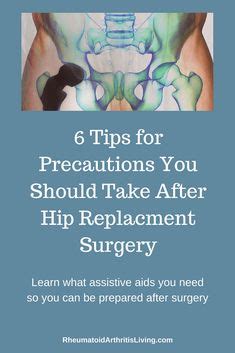 40 Hip arthritis ideas | hip arthritis, hip replacement surgery, arthritis