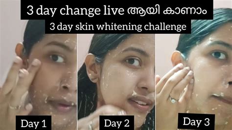 Day Skin Whitening Challenge Omg Amazing Result Youtube