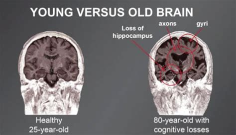 Why Healthy Aging Starts with Your Brain - Isagenix Health