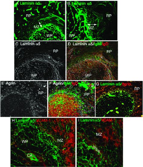 Immunofluorescence Staining For Laminin α5 Agrin Igm High Igd Low Mz Download Scientific