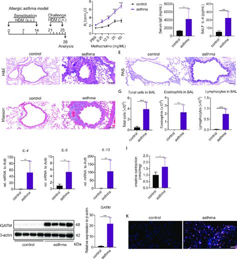 Pulmonary Expression Of Gatm And Creatine In Hdm Induced Asthma Model