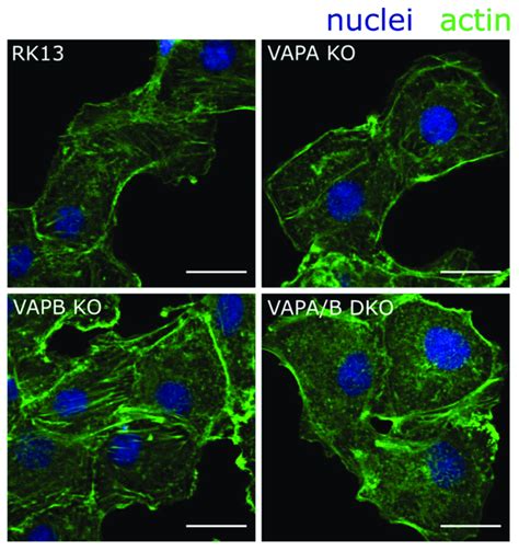 Actin Organization Is Perturbed In Rk Vapa B Dko Cells Rk