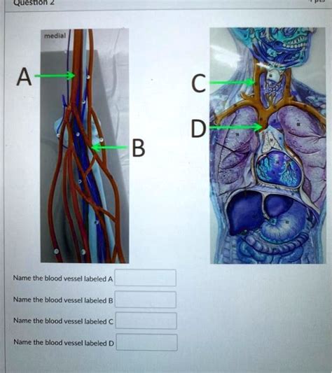 Solved Medial A C D B Name The Blood Vessel Labeled A Name The Blood