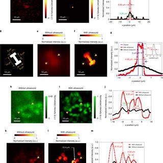 Evaluation Of The Imaging Performance Of Us Ocm A B Images Of A Nm