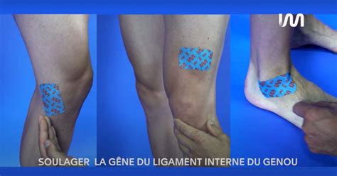 Soulager la gêne du ligament latéral interne du genou STIMCARE 1