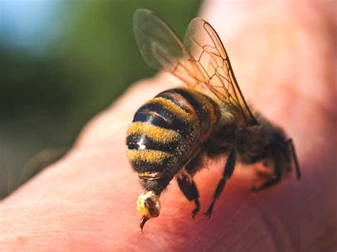 How Is an Infected Bee Sting Treated?