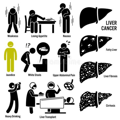 Liver Cancer Stock Illustrations 7686 Liver Cancer Stock Illustrations Vectors And Clipart