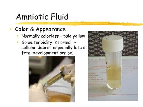 Amniotic Fluid Test Strip Color Leaselity