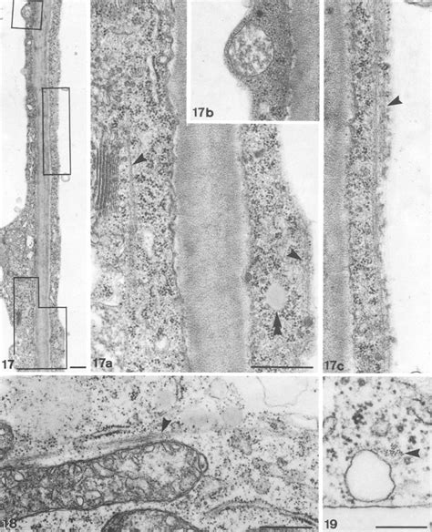 Low Power Electron Micrograph Showing Longitudinal Section Of Adjacent