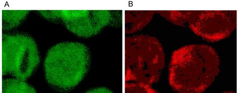 (A) Spectrin and (B) Actin (stained with antibody against β-actin ...