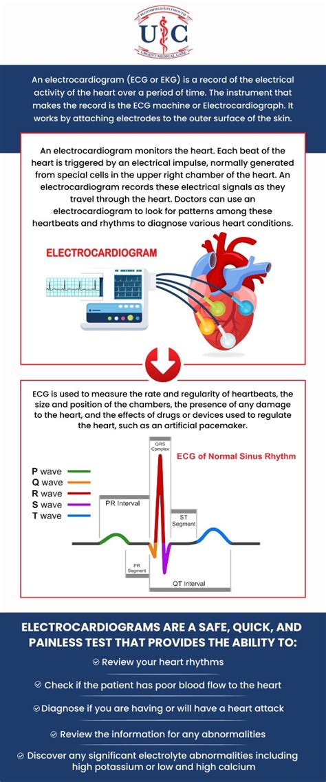 Signs That You May Need an Electrocardiogram (EKG) Test