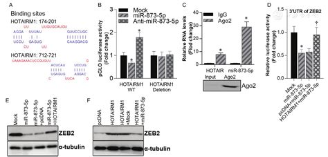 Long Non Coding Rna Hotairm1 Promotes Proliferation And Inhibits