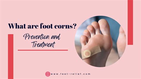 What Are Foot Corns? Treatments and Prevention - Feet Relief