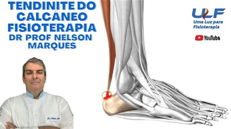 Tendinite do Calcâneo Fisioterapia Dr Prof Nelson Marques YouTube